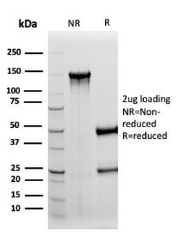 S100B Antibody
