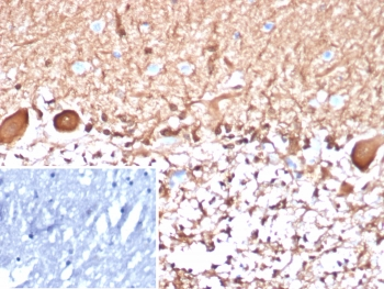 S100B Antibody