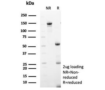 MX1 Antibody / MxA / Myxovirus resistance protein 1