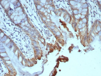 ICOS-L Antibody / ICOS Ligand / B7RP-1