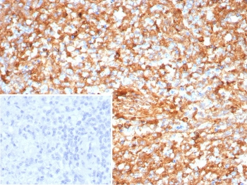 ICOS-L Antibody / ICOS Ligand / B7RP-1
