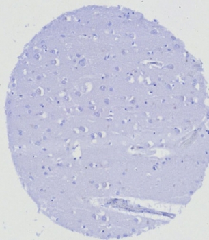 ERG Antibody / Transcriptional regulator ERG