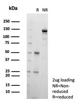 GIRK2 Antibody / KCNJ6