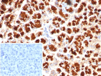 GIRK2 Antibody / KCNJ6
