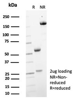 MIF Antibody / Macrophage migration inhibitory factor