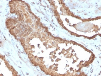 MIF Antibody / Macrophage migration inhibitory factor