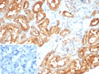 MIF Antibody / Macrophage migration inhibitory factor