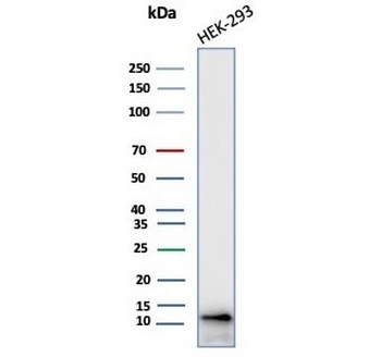 MIF Antibody / Macrophage migration inhibitory factor