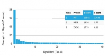 MIF Antibody / Macrophage migration inhibitory factor