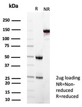 SOD1 Antibody / Superoxide Dismutase 1