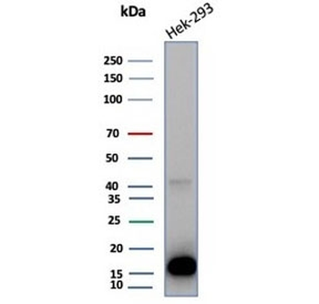 MIF Antibody / Macrophage migration inhibitory factor