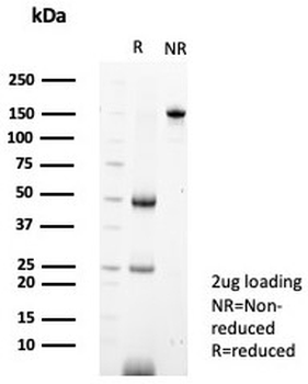 MIF Antibody / Macrophage migration inhibitory factor