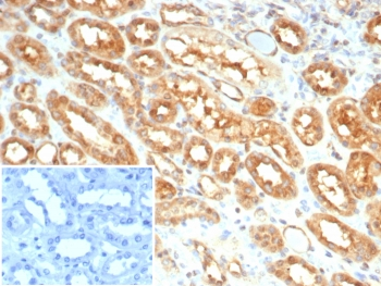 MIF Antibody / Macrophage migration inhibitory factor