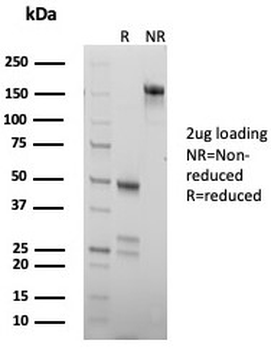 Chromogranin B Antibody / Secretogranin I