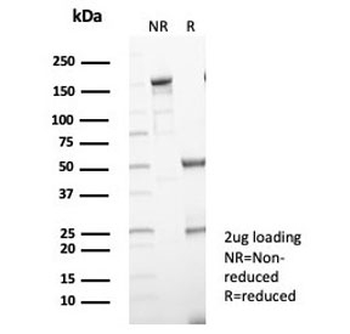LAMP5 Antibody / Lysosome-Associated Membrane Glycoprotein 5