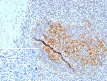 CD35 Antibody / Complement receptor 1