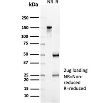 CD35 Antibody / CR1
