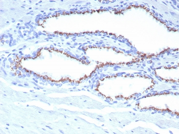 SLC45A3 Antibody / Solute carrier family 45 member 3 / Prostein