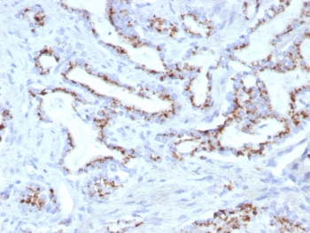 SLC45A3 Antibody / Solute carrier family 45 member 3 / Prostein