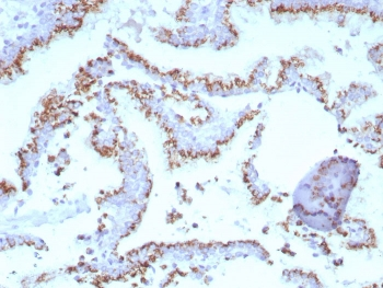 Prostein Antibody / SLC45A3