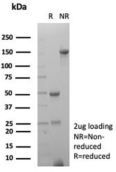 Prostein Antibody / SLC45A3