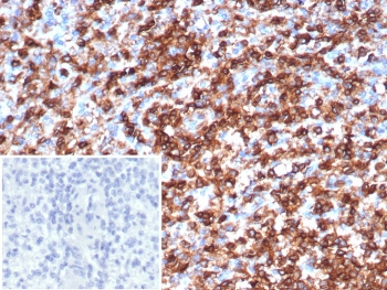 CD45 Antibody (Leukocyte marker)