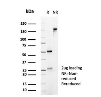CD45 Antibody (Leukocyte marker)