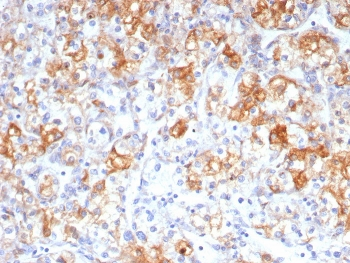 COX2 Antibody / Cyclooxygenase 2 / PTGS2
