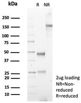 COX2 Antibody / Cyclooxygenase 2 / PTGS2