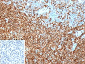 CD45RA Antibody (Leukocyte marker)