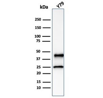 Glutamine Synthetase Antibody / GLUL
