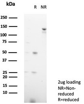 MPZ Antibody / Myelin Protein Zero