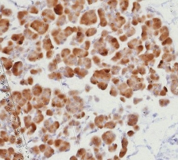 Recombinant ROR gamma Antibody / RORC