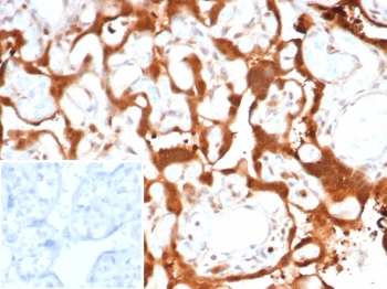S100A11 Antibody