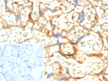 S100A11 Antibody