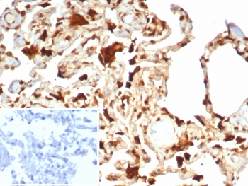S100A11 Antibody