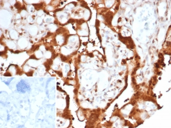 S100A11 Antibody