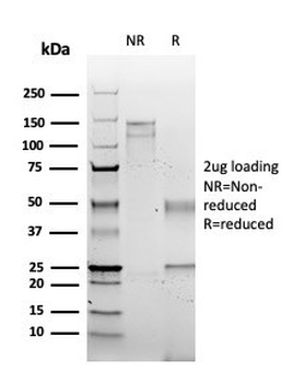 S100 Calcium Binding Protein A2 Antibody / S100A2