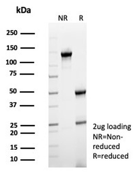 CD64 Antibody