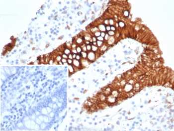 S100A16 Antibody