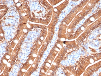 S100A16 Antibody