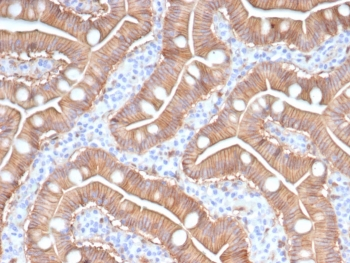 S100A16 Antibody