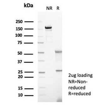 S100A14 Antibody
