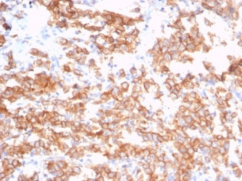 S100A14 Antibody