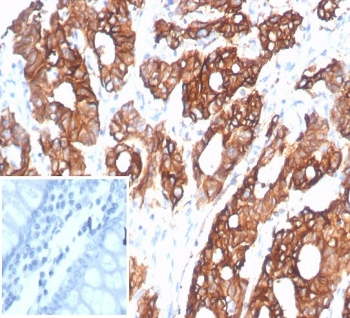 S100A14 Antibody
