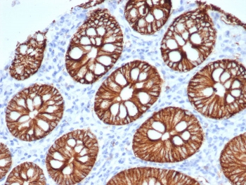 S100A14 Antibody