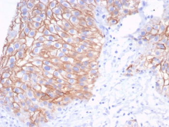S100A14 Antibody