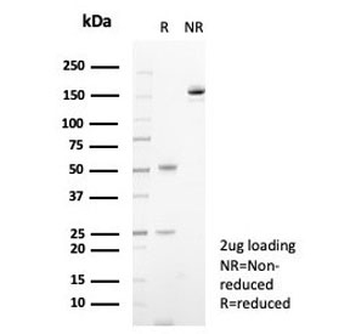 S100A14 Antibody