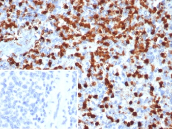 S100A9 Antibody / MRP14 / Calgranulin B / Calprotectin L1H