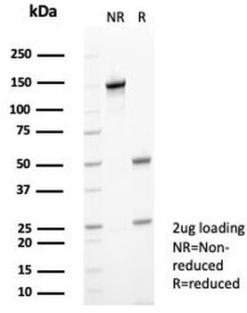 S100A9 Antibody / MRP14 / Calgranulin B / Calprotectin L1H